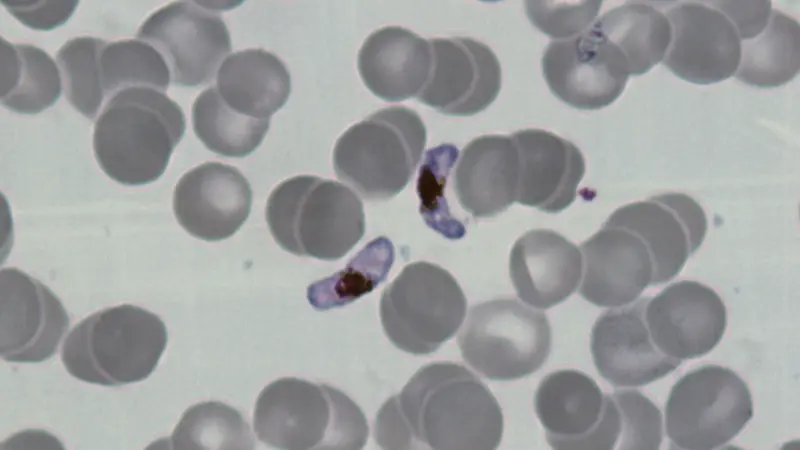 Remove one gene, and malaria can’t make transmissible forms
