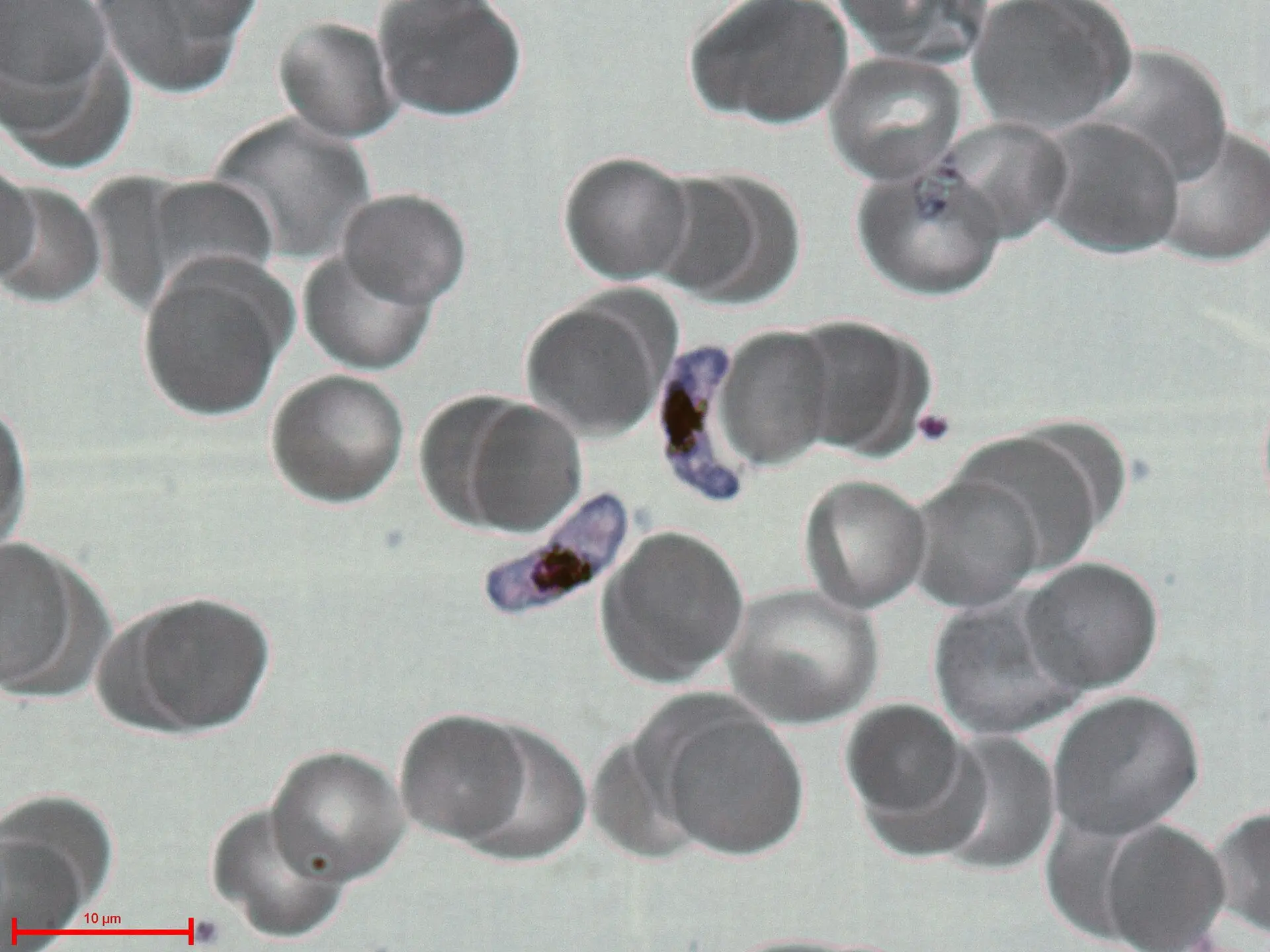 Remove one gene, and malaria can’t make transmissible forms