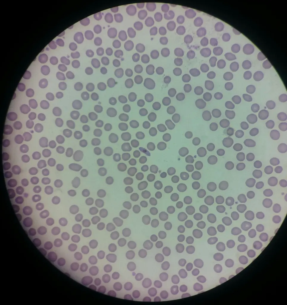 Under stress such as fever or nutrient limitation, P. falciparum increases production of gametocytes—the sexual forms transmissible to mosquitoes [c2][c3][c4].