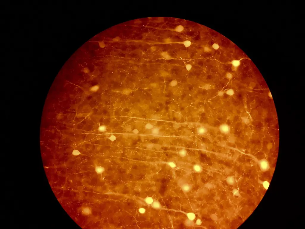 The Queensland Brain Institute at The University of Queensland developed NASTIC to watch protein behavior inside living neurons.