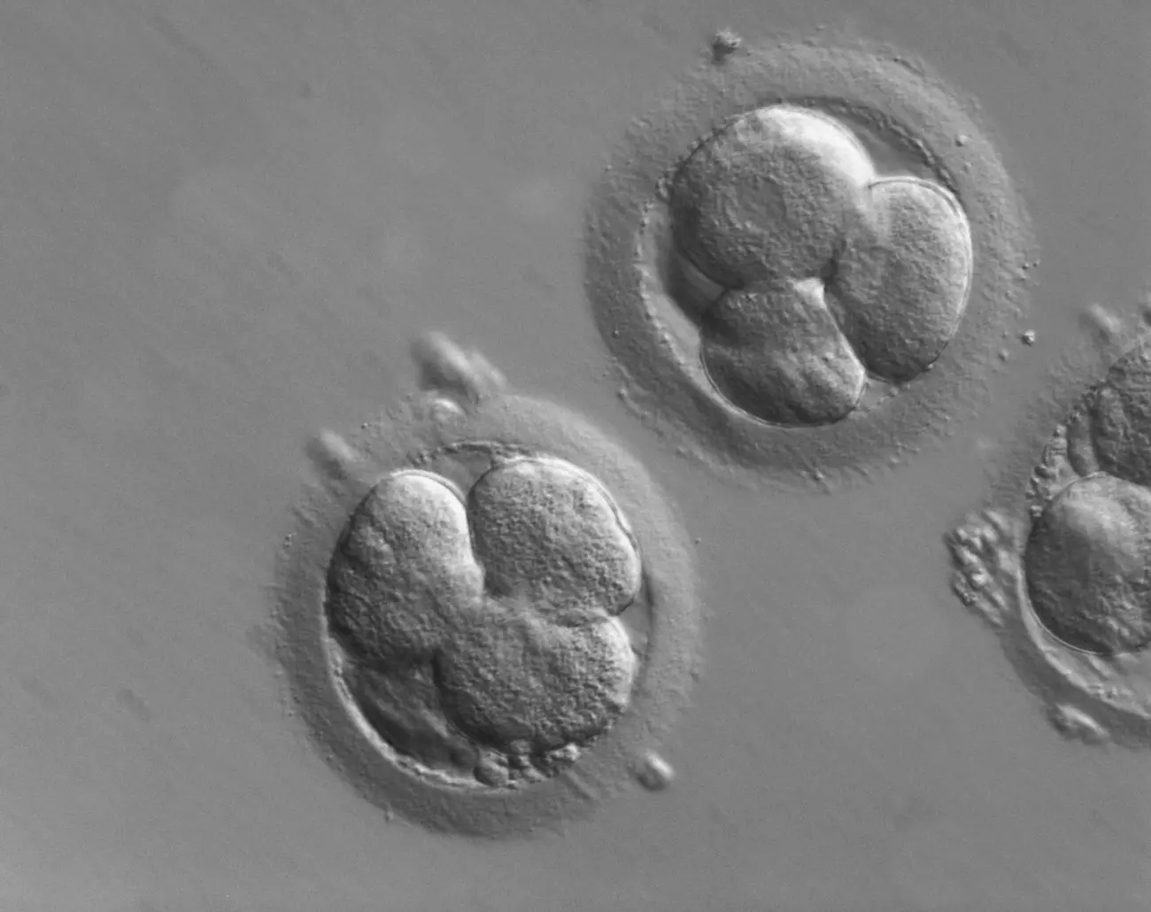 Three signals nudge a human gonad into being—mapped across 33 cell types