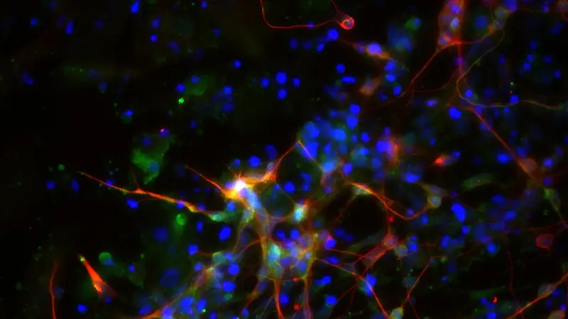 They filmed single molecules clustering inside living neurons