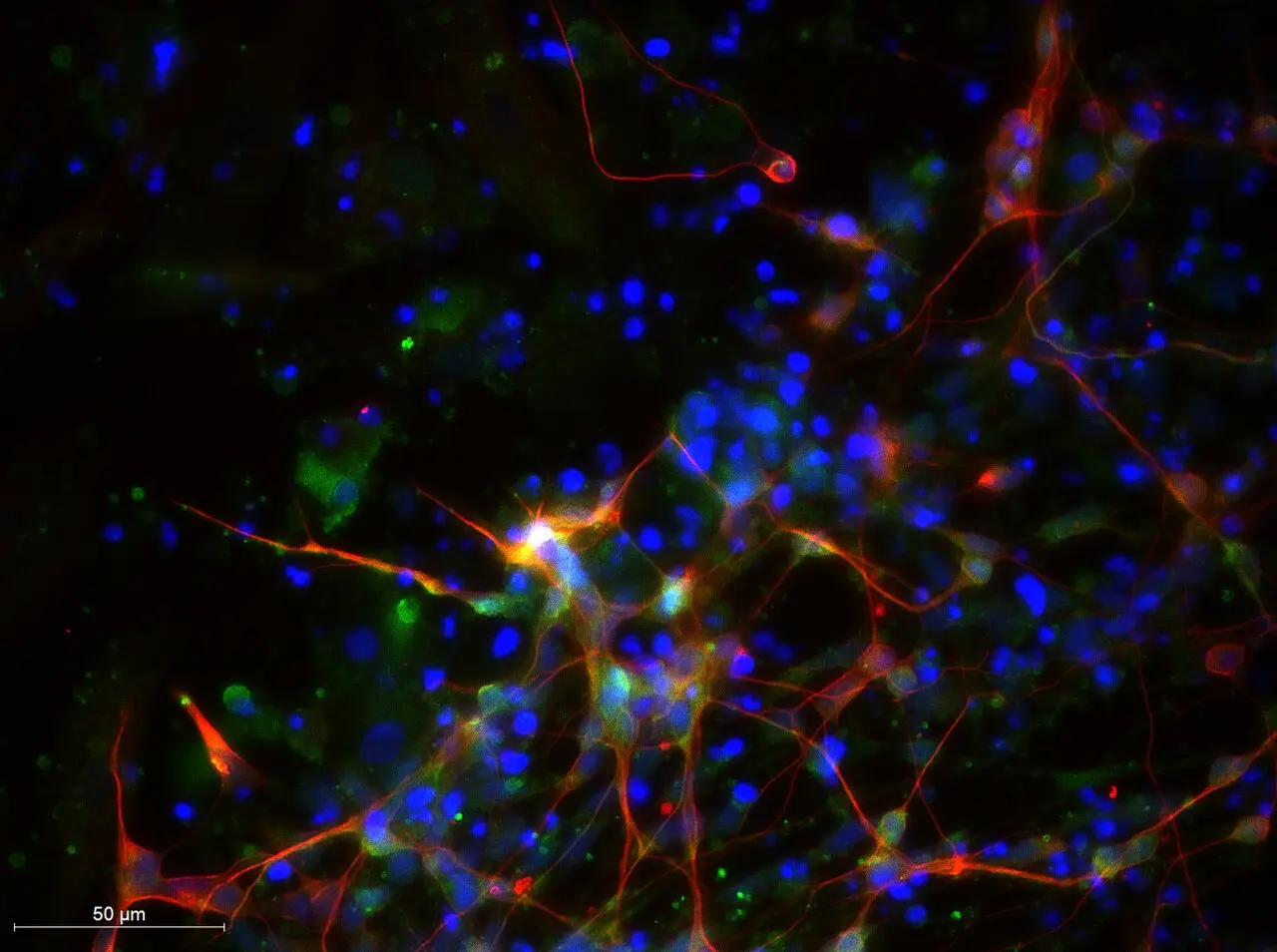 They filmed single molecules clustering inside living neurons